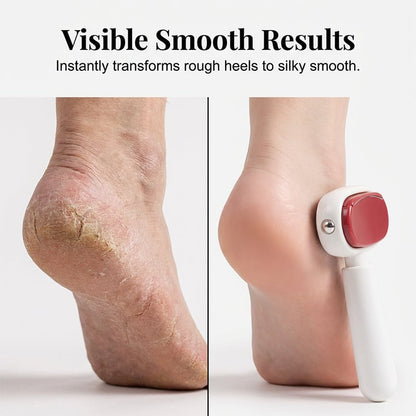 Double-Sided Foot Scraper for Callus Removal